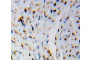 Used in DAB staining on fromalin fixed paraffin-embedded Brain tissue (HSPH1 抗体  (AA 388-505))