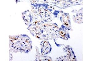 IHC-F testing of human placenta tissue (HSD17B2 抗体  (AA 373-387))