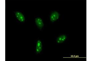 Immunofluorescence of purified MaxPab antibody to DDX24 on HeLa cell. (DDX24 抗体  (AA 1-804))