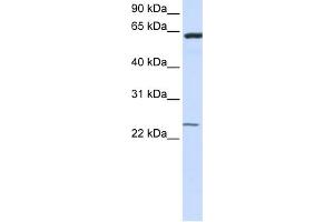 WB Suggested Anti-TMEM138 Antibody Titration:  0. (TMEM138 抗体  (N-Term))