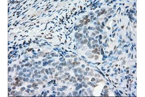 Immunohistochemical staining of paraffin-embedded colon tissue using anti-PRKYmouse monoclonal antibody. (PRKY 抗体)