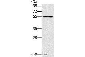 Western blot analysis of Mouse intestinum tenue tissue, using PUS10 Polyclonal Antibody at dilution of 1:200 (PUS10 抗体)
