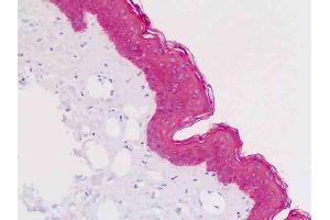 Anti-KRT5 / CK5 / Cytokeratin 5 antibody IHC staining of human skin, epidermis. (Cytokeratin 5 抗体  (AA 158-272))