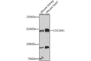 Western blot analysis of extracts of various cell lines, using COL16 antibody (8837) at 1:1000 dilution. (COL16A1 抗体  (AA 1000-1100))