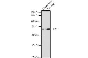 Western blot analysis of extracts of various cell lines, using F2R antibody (ABIN6132223, ABIN6140404, ABIN6140405 and ABIN6221279) at 1:1000 dilution. (PAR1 抗体  (AA 42-110))