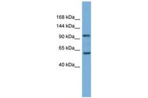 Image no. 1 for anti-Phosphatidylinositol 4-Kinase, Catalytic, beta (PI4KB) (AA 755-804) antibody (ABIN6745689)