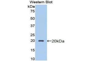 Western Blotting (WB) image for anti-Protein C Receptor, Endothelial (PROCR) (AA 63-205) antibody (ABIN1172000) (PROCR 抗体  (AA 63-205))