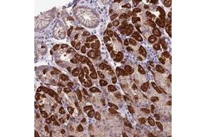 Immunohistochemical staining of human stomach with ETFDH polyclonal antibody  shows strong cytoplasmic positivity in glandular cells. (ETFDH 抗体)