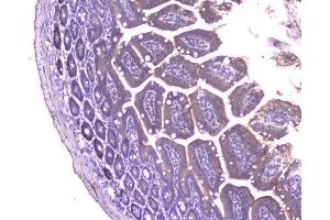 IHC analysis of CCL8 using anti-CCL8 antibody (ABIN6719605). (CCL8 抗体  (AA 24-97))