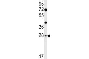 Western blot analysis of HES7 antibody and mouse heart tissue lysate. (HES7 抗体  (AA 26-55))
