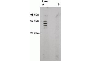 Image no. 1 for anti-Sphingomyelin Synthase 2 (SGMS2) antibody (ABIN793628) (Sphingomyelin Synthase 2 抗体)