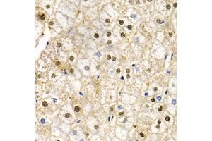 Immunohistochemistry of paraffin-embedded human liver injury using RAD9A antibody. (RAD9A 抗体)