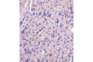 (ABIN650677 and ABIN2838644) staining EIF4E2 in human stomach tissue sections by Immunohistochemistry (IHC-P - paraformaldehyde-fixed, paraffin-embedded sections).
