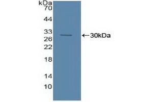 Western blot analysis of recombinant Human ASM. (SMPD1 抗体  (AA 319-579))