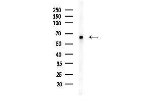 anti-SUMO1/sentrin/SMT3 Specific Peptidase 2 (SENP2) antibody