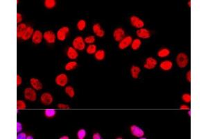 Immunofluorescence analysis of HeLa cells using SFPQ Polyclonal Antibody at dilution of 1:100 (40x lens). (SFPQ 抗体)