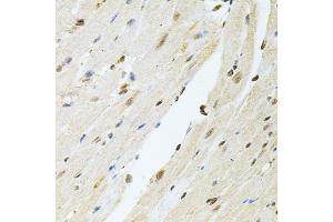 Immunohistochemistry of paraffin-embedded mouse heart using PNKP antibody (ABIN2564598) at dilution of 1:100 (40x lens). (PNKP 抗体)