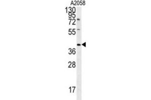Western Blotting (WB) image for anti-CD99 Molecule-Like 2 (CD99L2) antibody (ABIN3002368) (CD99L2 抗体)