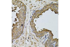 Immunohistochemistry of paraffin-embedded human prostate using MTIF3 antibody.
