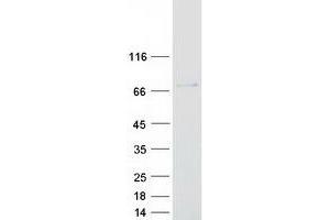 Western Blotting (WB) image for Nucleoporin Like 1 (NUPL1) (Transcript Variant 1) protein (Myc-DYKDDDDK Tag) (ABIN2727827)