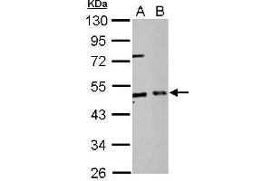 WB Image EIF2 beta antibody detects EIF2S2 protein by Western blot analysis.