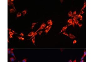 Immunofluorescence analysis of NIH/3T3 cells using PGRMC2 Polyclonal Antibody at dilution of 1:100. (PGRMC2 抗体)
