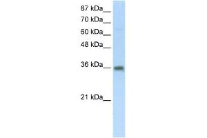 WB Suggested Anti-SFRS10 Antibody Titration:  5. (TRA2B 抗体  (Middle Region))