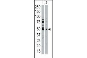 Western Blotting (WB) image for anti-serum/glucocorticoid Regulated Kinase 2 (SGK2) (AA 1-30), (N-Term) antibody (ABIN1882131)