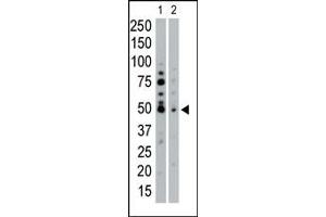 The anti-SGK2 Pab (ABIN1882131 and ABIN2842048) is used in Western blot to detect SGK2 in HeLa cell lysate (Lane 1) and mouse pancreas tissue lysate (Lane 2). (SGK2 抗体  (N-Term))