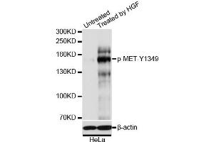 Immunofluorescence analysis of U2OS cells using Phospho-MET-Y1349 antibody (ABIN5969922). (c-MET 抗体  (pTyr1349))