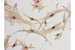 Immunohistochemistry (IHC) image for anti-Glial Fibrillary Acidic Protein (GFAP) (C-Term) antibody (ABIN3020751)