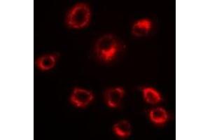 Immunofluorescent analysis of Serpin A10 staining in HepG2 cells. (SERPINA10 抗体)