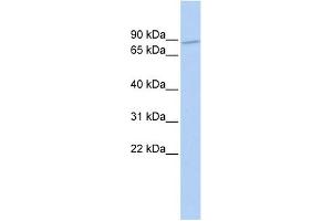 WB Suggested Anti-ZNF800 Antibody Titration:  0. (ZNF800 抗体  (N-Term))