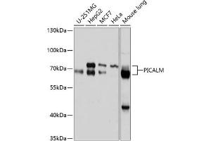 Western blot analysis of extracts of various cell lines, using PICALM antibody (ABIN6132898, ABIN6145606, ABIN6145607 and ABIN6214874) at 1:1000 dilution.