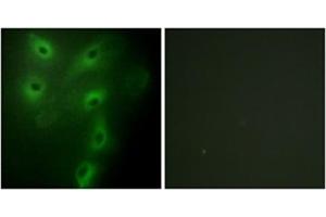Immunofluorescence analysis of HeLa cells, using TRIM59 Antibody .