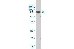 LIMK1 monoclonal antibody (M02), clone 1B2 Western Blot analysis of LIMK1 expression in Hela S3 NE . (LIM Domain Kinase 1 抗体  (AA 548-647))