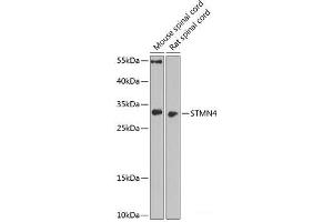 Western blot analysis of extracts of various cell lines using STMN4 Polyclonal Antibody at dilution of 1:1000. (STMN4 抗体)