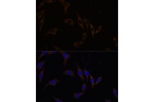 Immunofluorescence analysis of L929 cells using RGS4 antibody (ABIN7269898) at dilution of 1:100.