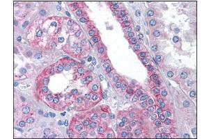 Human Kidney: Formalin-Fixed, Paraffin-Embedded (FFPE) (Flotillin 2 抗体  (C-Term))