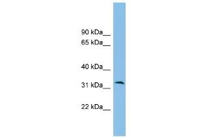 WB Suggested Anti-ZPBP2 Antibody Titration: 0. (ZPBP2 抗体  (Middle Region))