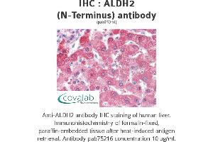 Image no. 1 for anti-Aldehyde Dehydrogenase 2 Family (Mitochondrial) (ALDH2) (N-Term) antibody (ABIN5693475) (ALDH2 抗体  (N-Term))