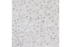 Immunohistochemistry (IHC) image for anti-Zinc Finger Protein 148 (ZNF148) (AA 690-794) antibody (ABIN6150463)