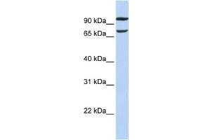 Western Blotting (WB) image for anti-Family with Sequence Similarity 38, Member B (FAM38B) antibody (ABIN2459321)