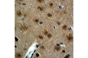 Immunohistochemical analysis of GAP43 staining in mouse brain formalin fixed paraffin embedded tissue section. (GAP43 抗体)