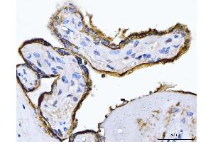 IHC analysis of ALPP using anti-ALPP antibody (ABIN7602772).