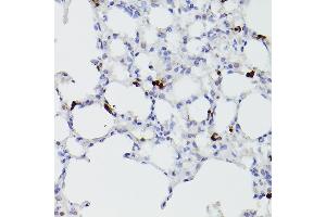 Immunohistochemistry of paraffin-embedded mouse lung using S100 Rabbit pAb (842) at dilution of 1:100 (40x lens). (S100A9 抗体  (AA 1-114))