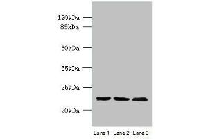 Western blot All lanes: WDYHV1 antibody at 6 μg/mL Lane 1: Mouse heart tissue Lane 2: MCF-7 whole cell lysate Lane 3: U251 whole cell lysate Secondary Goat polyclonal to Rabbit IgG at 1/10000 dilution Predicted band size: 24, 17 kDa Observed band size: 24 kDa (WDYHV1 抗体  (N-Term))