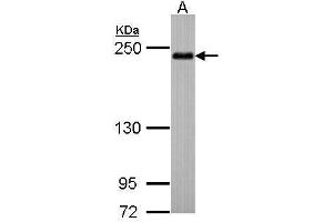 WB Image Sample (30 ug of whole cell lysate) A: Hep G2 , 5% SDS PAGE antibody diluted at 1:500 (SHROOM2 抗体  (C-Term))