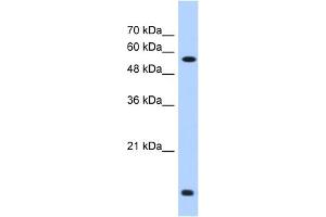 WB Suggested Anti-P4HB Antibody Titration:  0. (P4HB 抗体  (C-Term))