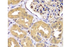 Immunohistochemistry of paraffin-embedded Human kidney using LZTR1 Polyclonal Antibody at dilution of 1:100 (40x lens). (LZTR1 抗体)
